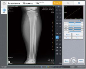 Hệ thống thu nhận ảnh kỹ thuật số cho máy X- quang Drtech Hàn Quốc